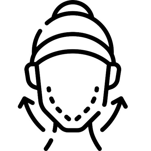 بلفاروپلاستی