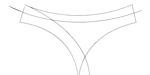 فیلر بادی چیست؟ کاربرد در هیپ دیپ، باسن و فرمدهی بدن