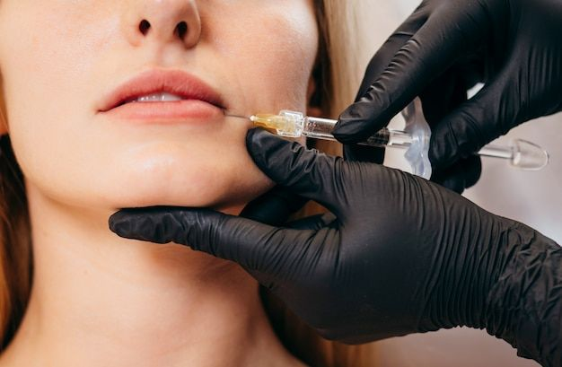 تزریق فیلر صورت بررسی کاربردها در لب، گونه و خط خنده